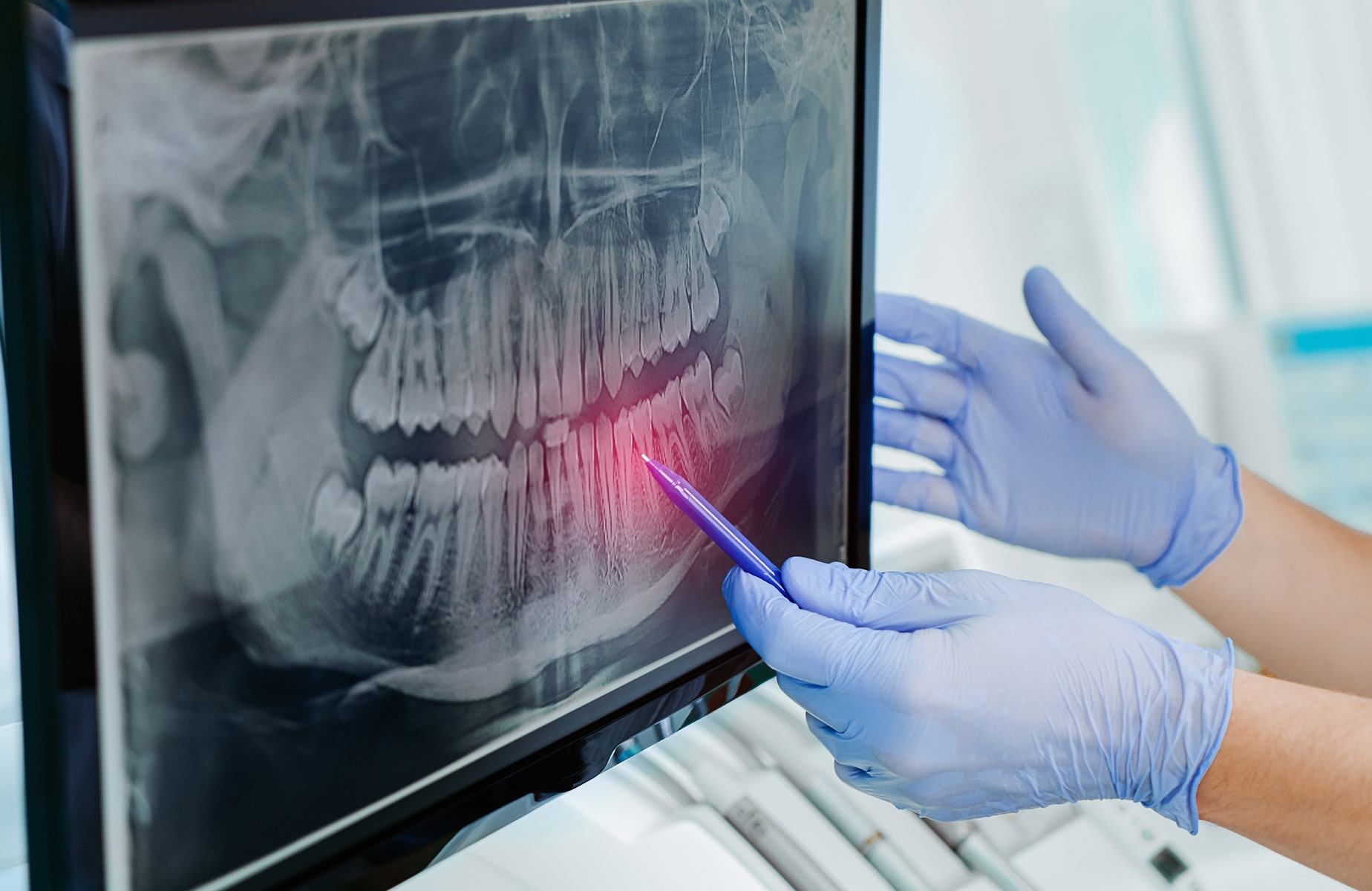 Implant dentist in Oklahoma City, OK
